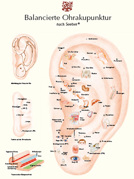 Akupunktur des Ohres, Ohrakupunktur